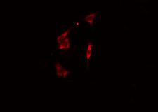 BST2 Antibody - Staining HeLa cells by IF/ICC. The samples were fixed with PFA and permeabilized in 0.1% Triton X-100, then blocked in 10% serum for 45 min at 25°C. The primary antibody was diluted at 1:200 and incubated with the sample for 1 hour at 37°C. An Alexa Fluor 594 conjugated goat anti-rabbit IgG (H+L) antibody, diluted at 1/600, was used as secondary antibody.