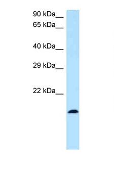 BST2 Antibody - BST2 antibody Western blot of Fetal Lung lysate. Antibody concentration 1 ug/ml.  This image was taken for the unconjugated form of this product. Other forms have not been tested.