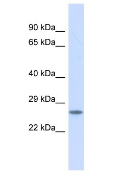 BSX Antibody - BSX antibody Western Blot of Placenta. Antibody dilution: 1 ug/ml.  This image was taken for the unconjugated form of this product. Other forms have not been tested.