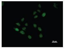 BTAF1 / TAF-172 Antibody - Immunofluorescent staining using BTAF1 antibody. Immunostaining analysis in HeLa cells. HeLa cells were fixed with 4% paraformaldehyde and permeabilized with 0.1% Triton X-100 in PBS. The cells were stained with anti-BTAF1 antibody.