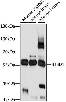 BTBD1 Antibody - Western blot analysis of extracts of various cell lines, using BTBD1 antibody at 1:1000 dilution. The secondary antibody used was an HRP Goat Anti-Rabbit IgG (H+L) at 1:10000 dilution. Lysates were loaded 25ug per lane and 3% nonfat dry milk in TBST was used for blocking. An ECL Kit was used for detection and the exposure time was 10s.