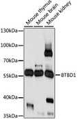 BTBD1 Antibody - Western blot analysis of extracts of various cell lines, using BTBD1 antibody at 1:1000 dilution. The secondary antibody used was an HRP Goat Anti-Rabbit IgG (H+L) at 1:10000 dilution. Lysates were loaded 25ug per lane and 3% nonfat dry milk in TBST was used for blocking. An ECL Kit was used for detection and the exposure time was 10s.