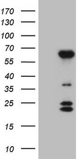 BTBD10 / GMRP-1 Antibody - HEK293T cells were transfected with the pCMV6-ENTRY control. (Left lane) or pCMV6-ENTRY BTBD10. (Right lane) cDNA for 48 hrs and lysed. Equivalent amounts of cell lysates. (5 ug per lane) were separated by SDS-PAGE and immunoblotted with anti-BTBD10. (1:2000)