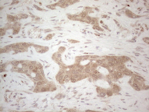BTBD10 / GMRP-1 Antibody - Immunohistochemical staining of paraffin-embedded Human liver tissue within the normal limits using anti-BTBD10 mouse monoclonal antibody. (Heat-induced epitope retrieval by 1mM EDTA in 10mM Tris buffer. (pH8.5) at 120°C for 3 min. (1:150)