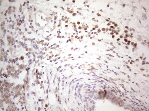 BTBD10 / GMRP-1 Antibody - Immunohistochemical staining of paraffin-embedded Human bladder tissue within the normal limits using anti-BTBD10 mouse monoclonal antibody. (Heat-induced epitope retrieval by 1mM EDTA in 10mM Tris buffer. (pH8.5) at 120°C for 3 min. (1:150)