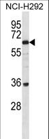 BTBD16 Antibody - BTBDG Antibody western blot of NCI-H292 cell line lysates (35 ug/lane). The BTBDG antibody detected the BTBDG protein (arrow).