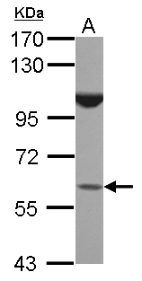 BTBD16 Antibody - Sample (30 ug of whole cell lysate) A: IMR32 7.5% SDS PAGE BTBD16 antibody diluted at 1:1000