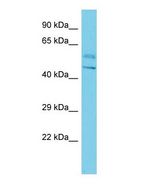 BTBD16 Antibody - Western blot of BTBD16 Antibody - N-terminal region with human HepG2 cells lysate.  This image was taken for the unconjugated form of this product. Other forms have not been tested.