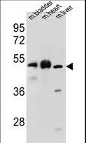 BTBD17 Antibody - BTBD17 Antibody western blot of mouse bladder,heart,liver tissue lysates (35 ug/lane). The BTBD17 antibody detected the BTBD17 protein (arrow).