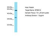 BTBD19 Antibody -  This image was taken for the unconjugated form of this product. Other forms have not been tested.