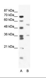 BTBD3 Antibody - A: Marker, B: Jurkat Cell Lysate.  This image was taken for the unconjugated form of this product. Other forms have not been tested.