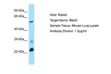 BTBD3 Antibody -  This image was taken for the unconjugated form of this product. Other forms have not been tested.