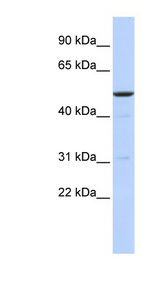BTBD3 Antibody - BTBD3 antibody Western blot of MCF7 cell lysate. This image was taken for the unconjugated form of this product. Other forms have not been tested.