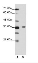 BTBD6 Antibody - A: Marker, B: HepG2 Cell Lysate.  This image was taken for the unconjugated form of this product. Other forms have not been tested.