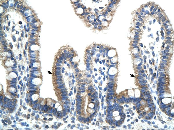 BTBD6 Antibody - BTBD6 antibody ARP39756_T100-NP_150374-BTBD6 (BTB (POZ) domain containing 6) Antibody was used in IHC to stain formalin-fixed, paraffin-embedded human intestine.  This image was taken for the unconjugated form of this product. Other forms have not been tested.