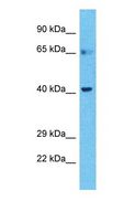 BTBD6 Antibody - Western blot of BTBD6 Antibody with human Stomach Tumor lysate.  This image was taken for the unconjugated form of this product. Other forms have not been tested.