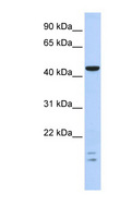 BTBD6 Antibody - BTBD6 antibody Western blot of Fetal Brain lysate. This image was taken for the unconjugated form of this product. Other forms have not been tested.