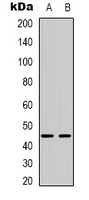 BTBD6 Antibody - Western blot analysis of BTBD6 expression in HepG2 (A); MCF7 (B) whole cell lysates.