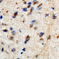 BTBD6 Antibody - Immunohistochemical analysis of BTBD6 staining in human brain formalin fixed paraffin embedded tissue section. The section was pre-treated using heat mediated antigen retrieval with sodium citrate buffer (pH 6.0). The section was then incubated with the antibody at room temperature and detected with HRP and DAB as chromogen. The section was then counterstained with hematoxylin and mounted with DPX.