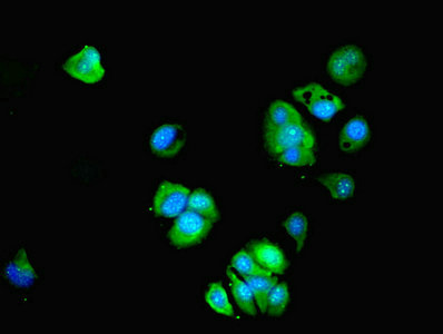 BTBD6 Antibody - Immunofluorescent analysis of MCF-7 cells using BTBD2 Antibody at dilution of 1:100 and Alexa Fluor 488-congugated AffiniPure Goat Anti-Rabbit IgG(H+L)