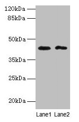BTBD6 Antibody - Western blot All lanes: BTBD2 antibody at 6µg/ml Lane 1: 293T whole cell lysate Lane 2: Hela whole cell lysate Secondary Goat polyclonal to rabbit IgG at 1/10000 dilution Predicted band size: 56, 23 kDa Observed band size: 44 kDa