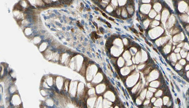 BTBD6 Antibody - 1:100 staining rat colon tissue by IHC-P. The sample was formaldehyde fixed and a heat mediated antigen retrieval step in citrate buffer was performed. The sample was then blocked and incubated with the antibody for 1.5 hours at 22°C. An HRP conjugated goat anti-rabbit antibody was used as the secondary.