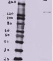 BTBD7 Antibody - BTBD7 antibody MDCK overexpressing Mouse Btbd7 (third lane) and probed with (mock transfection in first lane, full construct chemically suppressed in second lane).