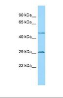 BTBD7 Antibody - Western blot of Human OVCAR-3. BTBD7 antibody dilution 1.0 ug/ml.  This image was taken for the unconjugated form of this product. Other forms have not been tested.