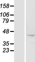 BTBD8 Protein - Western validation with an anti-DDK antibody * L: Control HEK293 lysate R: Over-expression lysate