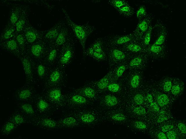 BTBD9 Antibody - Immunofluorescence staining of BTBD9 in U2OS cells. Cells were fixed with 4% PFA, permeabilzed with 0.1% Triton X-100 in PBS, blocked with 10% serum, and incubated with rabbit anti-Human BTBD9 polyclonal antibody (dilution ratio 1:100) at 4°C overnight. Then cells were stained with the Alexa Fluor 488-conjugated Goat Anti-rabbit IgG secondary antibody (green). Positive staining was localized to Nucleus.