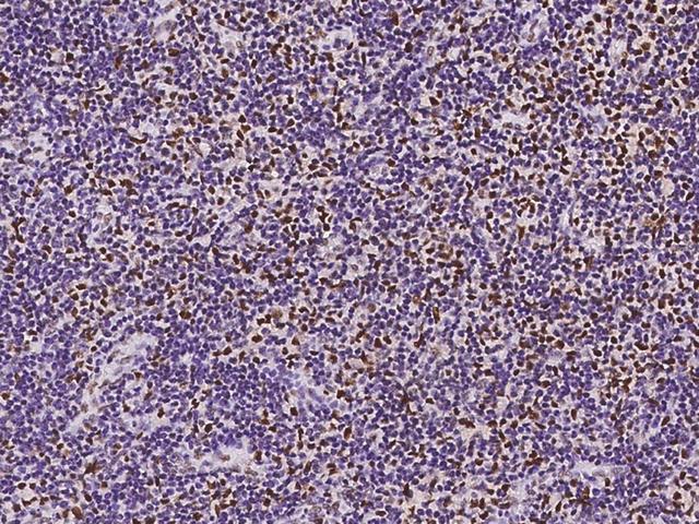 BTBD9 Antibody - Immunochemical staining of human BTBD9 in human lymph node with rabbit polyclonal antibody at 1:1000 dilution, formalin-fixed paraffin embedded sections.