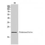 BTC / Betacellulin Antibody - Western blot of Probetacellulin antibody