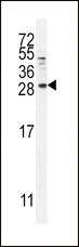 BTC / Betacellulin Antibody - BTC Antibody western blot of MDA-MB231 cell line lysates (35 ug/lane). The BTC antibody detected the BTC protein (arrow).