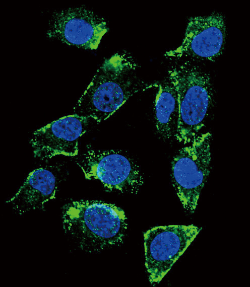 BTC / Betacellulin Antibody - Confocal immunofluorescence of BTC Antibody with MDA-MB231 cell followed by Alexa Fluor 488-conjugated goat anti-rabbit lgG (green). DAPI was used to stain the cell nuclear (blue).
