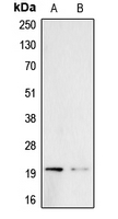 BTC / Betacellulin Antibody - Western blot analysis of Probetacellulin expression in A431 (A); PC3 (B) whole cell lysates.