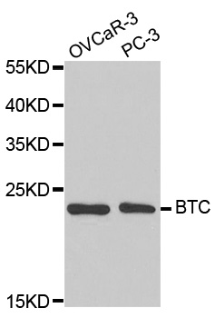 BTC / Betacellulin Antibody - Western blot analysis of extracts of various cell lines, using BTC antibody.