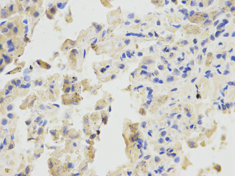 BTC / Betacellulin Antibody - Immunohistochemistry of paraffin-embedded human lung using BTC antibody at dilution of 1:200 (400x lens).