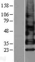 BTC / Betacellulin Protein - Western validation with an anti-DDK antibody * L: Control HEK293 lysate R: Over-expression lysate
