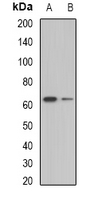 BTD / Biotinidase Antibody - Western blot analysis of Biotinidase expression in mouse liver (A); mouse kidney (B) whole cell lysates.