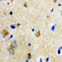 BTD / Biotinidase Antibody - Immunohistochemical analysis of Biotinidase staining in rat brain formalin fixed paraffin embedded tissue section. The section was pre-treated using heat mediated antigen retrieval with sodium citrate buffer (pH 6.0). The section was then incubated with the antibody at room temperature and detected using an HRP conjugated compact polymer system. DAB was used as the chromogen. The section was then counterstained with hematoxylin and mounted with DPX.