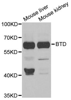 BTD / Biotinidase Antibody - Western blot analysis of extracts of various tissues.