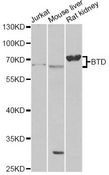 BTD / Biotinidase Antibody - Western blot analysis of extracts of various cell lines, using BTD antibody at 1:1000 dilution. The secondary antibody used was an HRP Goat Anti-Rabbit IgG (H+L) at 1:10000 dilution. Lysates were loaded 25ug per lane and 3% nonfat dry milk in TBST was used for blocking. An ECL Kit was used for detection and the exposure time was 90s.