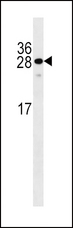 BTEB / KLF9 Antibody - KLF9 Antibody western blot of WiDr cell line lysates (35 ug/lane). The KLF9 antibody detected the KLF9 protein (arrow).