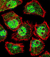 BTEB / KLF9 Antibody - Fluorescent confocal image of U251 cell stained with KLF9 Antibody. U251 cells were fixed with 4% PFA (20 min), permeabilized with Triton X-100 (0.1%, 10 min), then incubated with KLF9 primary antibody (1:25, 1 h at 37°C). For secondary antibody, Alexa Fluor 488 conjugated donkey anti-rabbit antibody (green) was used (1:400, 50 min at 37°C). Cytoplasmic actin was counterstained with Alexa Fluor 555 (red) conjugated Phalloidin (7units/ml, 1 h at 37°C). Nuclei were counterstained with DAPI (blue) (10 ug/ml, 10 min). KLF9 immunoreactivity is localized to vesicles and Nucleus significantly.