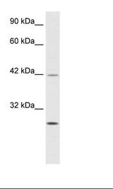 BTEB / KLF9 Antibody - Jurkat Cell Lysate.  This image was taken for the unconjugated form of this product. Other forms have not been tested.