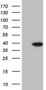 BTEB / KLF9 Antibody - HEK293T cells were transfected with the pCMV6-ENTRY control. (Left lane) or pCMV6-ENTRY KLF9. (Right lane) cDNA for 48 hrs and lysed