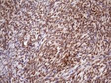 BTEB / KLF9 Antibody - Immunohistochemical staining of paraffin-embedded Human Ovary tissue within the normal limits using anti-KLF9 mouse monoclonal antibody. (Heat-induced epitope retrieval by 1mM EDTA in 10mM Tris buffer. (pH8.5) at 120 oC for 3 min. (1:150)