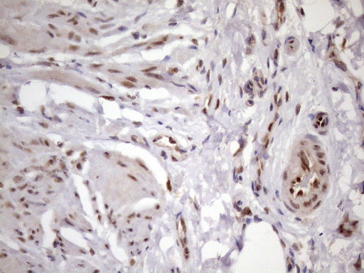 BTEB / KLF9 Antibody - Immunohistochemical staining of paraffin-embedded Human bladder tissue within the normal limits using anti-KLF9 mouse monoclonal antibody. (Heat-induced epitope retrieval by 1mM EDTA in 10mM Tris buffer. (pH8.5) at 120 oC for 3 min. (1:150)