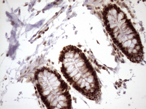 BTEB / KLF9 Antibody - Immunohistochemical staining of paraffin-embedded Human colon tissue within the normal limits using anti-KLF9 mouse monoclonal antibody. (Heat-induced epitope retrieval by 1mM EDTA in 10mM Tris buffer. (pH8.5) at 120 oC for 3 min. (1:150)