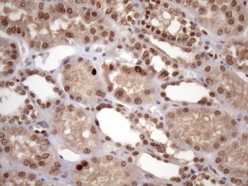 BTEB / KLF9 Antibody - Immunohistochemical staining of paraffin-embedded Human Kidney tissue within the normal limits using anti-KLF9 mouse monoclonal antibody. (Heat-induced epitope retrieval by 1mM EDTA in 10mM Tris buffer. (pH8.5) at 120 oC for 3 min. (1:150)